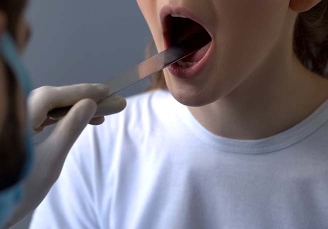 Starke Halsschmerzen